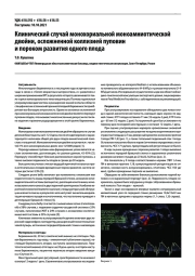 КЛИНИЧЕСКИЙ СЛУЧАЙ МОНОХОРИАЛЬНОЙ МОНОАМНИОТИЧЕСКОЙ ДВОЙНИ, ОСЛОЖНЕННОЙ КОЛЛИЗИЕЙ ПУПОВИН И ПОРОКОМ РАЗВИТИЯ ОДНОГО ПЛОДА