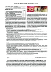ОСОБЕННОСТИ ОБУЧЕНИЯ ВИДАМ РЕЧЕВОЙ ДЕЯТЕЛЬНОСТИ В ВЫСШЕЙ ШКОЛЕ НА ПРИМЕРЕ СТУДЕНТОВ ФИНУНИВЕРСИТЕТА